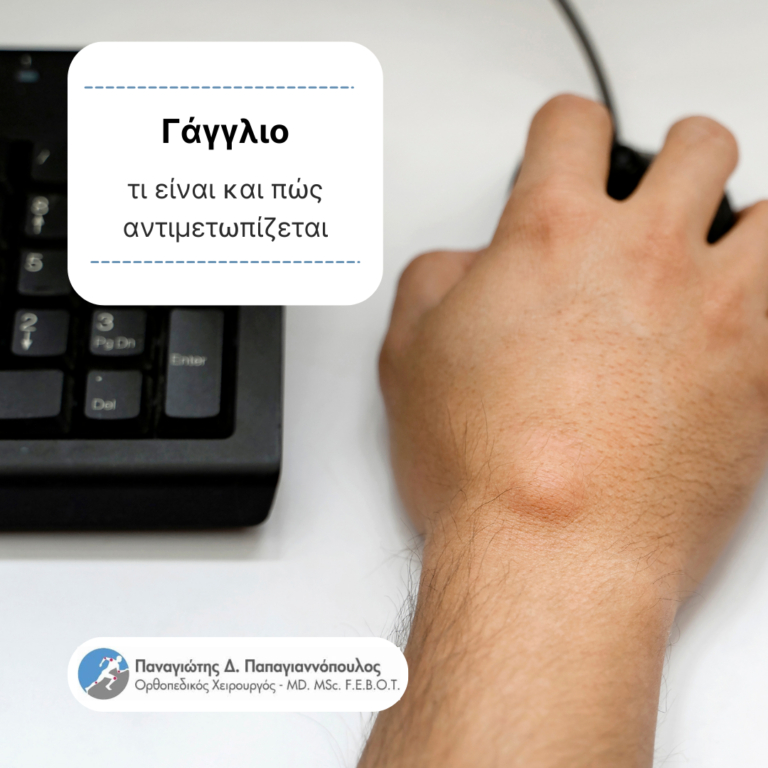 γάγγλιο cover