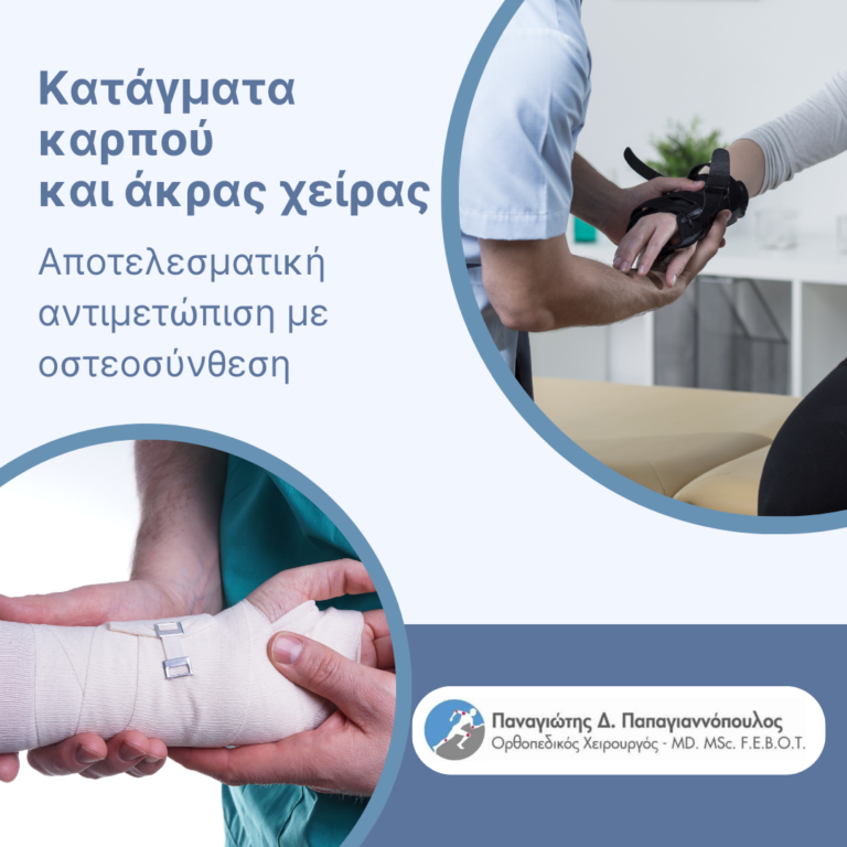 κατάγματα καρπού cover