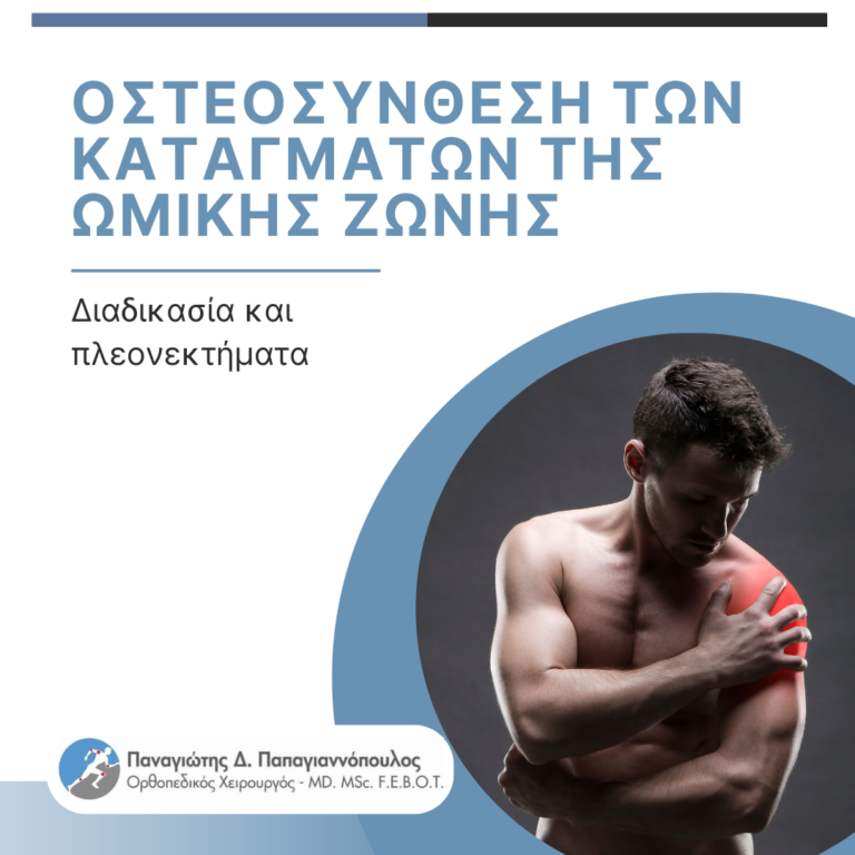 κατάγματα στην ωμική ζώνη cover