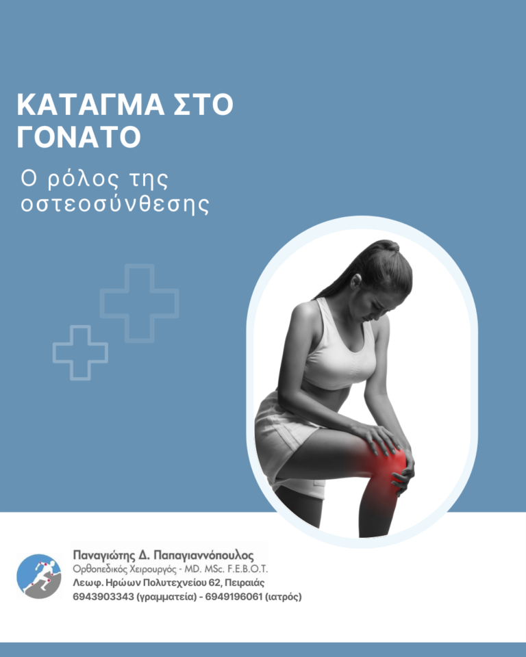 Κάταγμα στο γόνατο και ο ρόλος της οστεοσύνθεσης