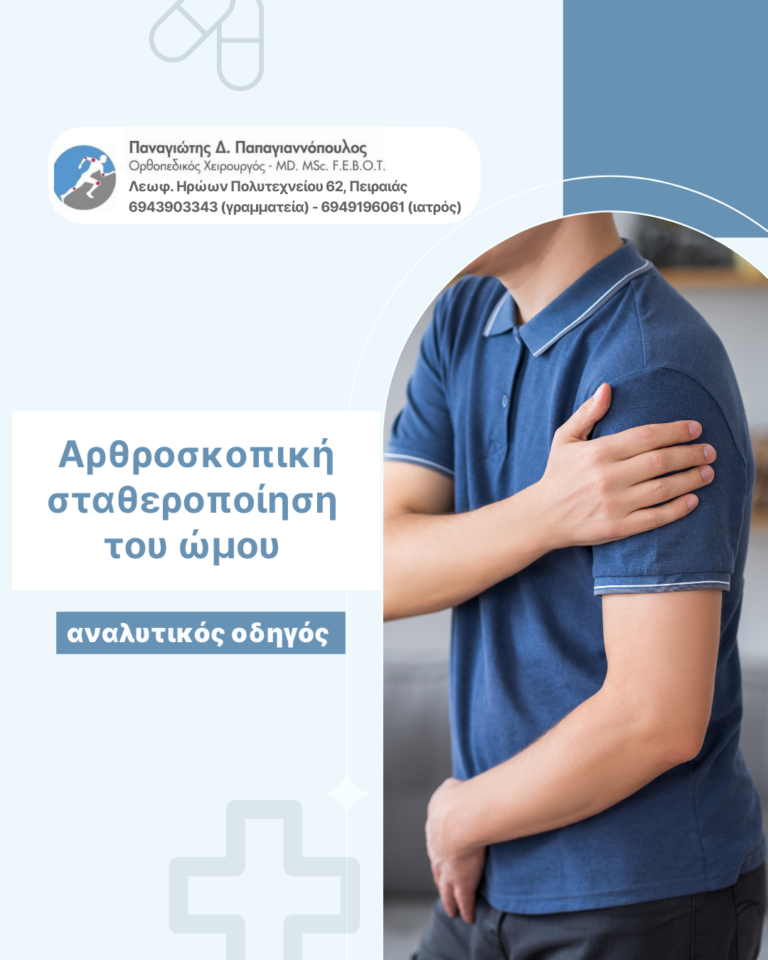 αρθροσκοπική σταθεροποίηση του ώμου cover