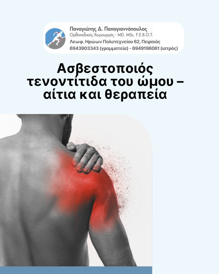 ασβεστοποιός τενοντίτιδα του ώμου cover